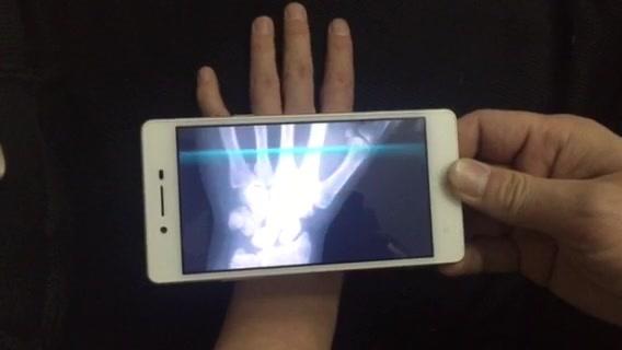 E骨骼骨骼扫描扫描软件