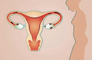 How doesn't the woman have an uterus to meet? Con