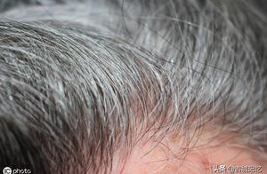 Early unripe white hair is antagonism likely gawkish
