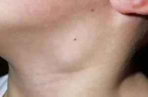 Is you think suffer from excessive internal heat? 