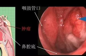 You think is suffer from excessive internal heat, 