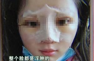 After woman loan becomes face-lifting operation "