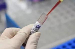 How GET " much can apothecary " full marks skill