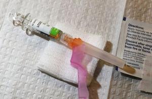 American hives case of illness erupts today achiev