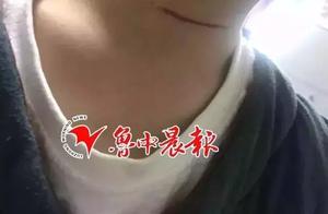 Danger of 4 years old of children is cut larynx! \