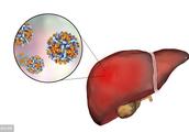 Liver of 3 kinds of second fights virus a gleam of