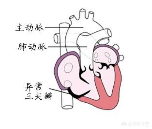 三尖瓣下移畸形_介绍_症状表现 - 好大夫在线