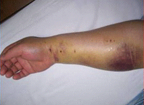 心脏造影的目的是什么?