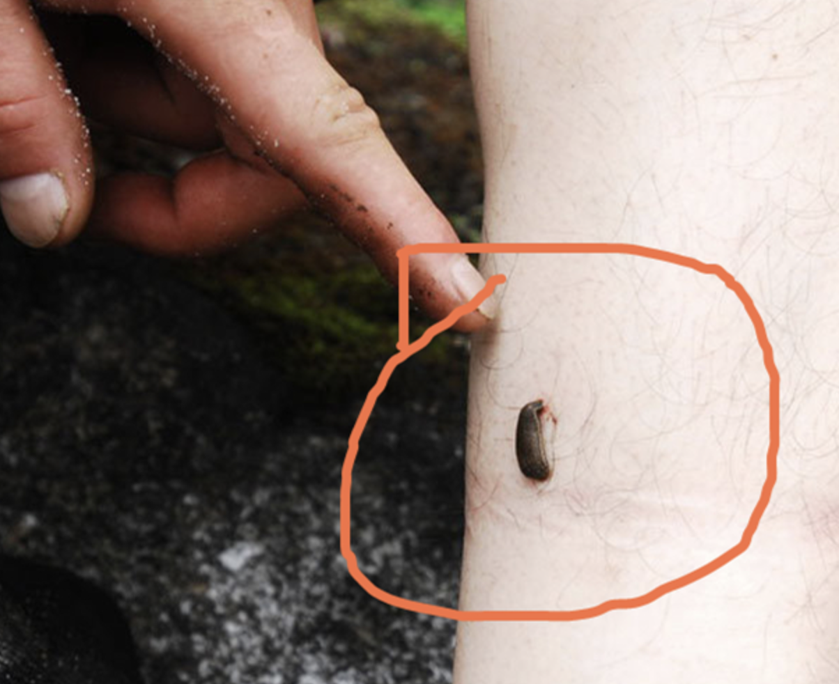 图片[7]-水蛭在人的肚子里还可以活吗?-乐学小窝